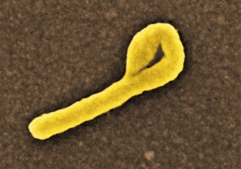  painting titled Ebola virus